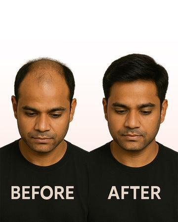 Hair Transformation
